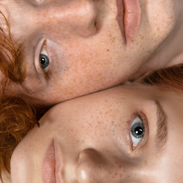 Serum για ευαίσθητο δέρμα: Τα συστατικά που θα πρέπει να αναζητάτε