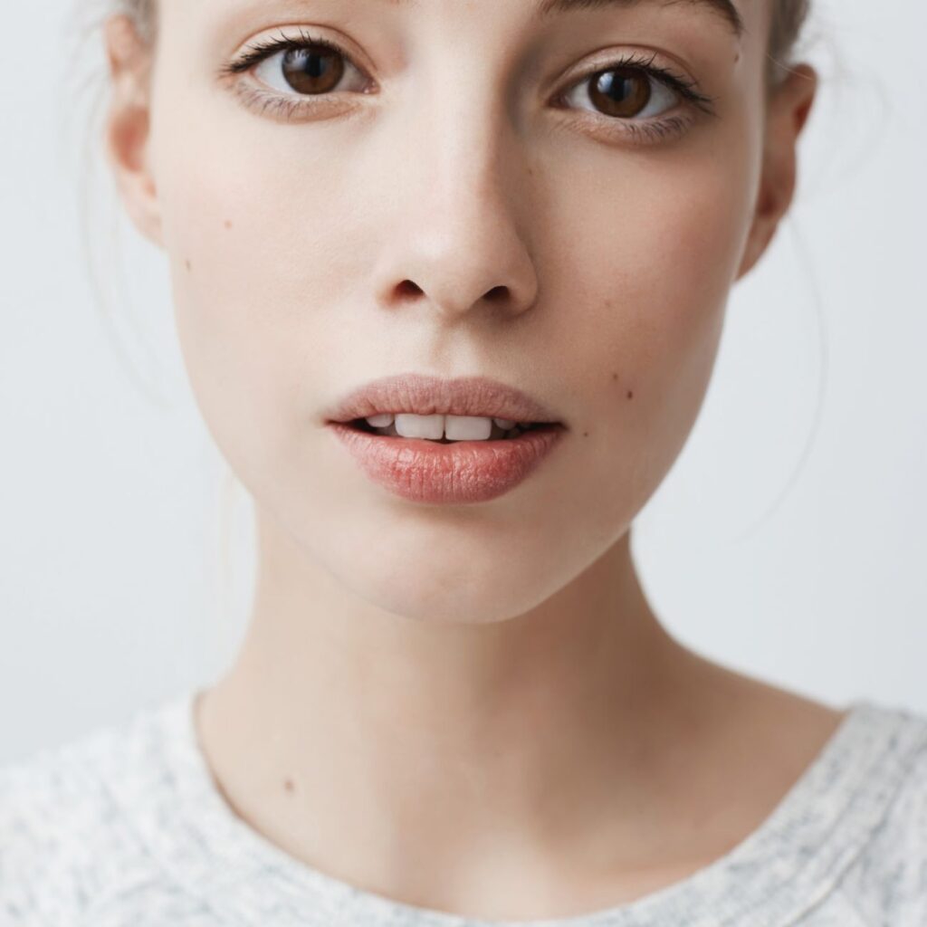 Σκασμένα χείλη; Δείτε ποιες βιταμίνες μπορεί να σας λείπουν